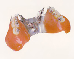 クラウン歯科｜義歯（入れ歯）の種類や特徴紹介